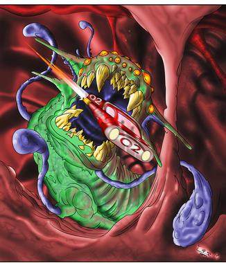 Helicobacter Pylori-Queen